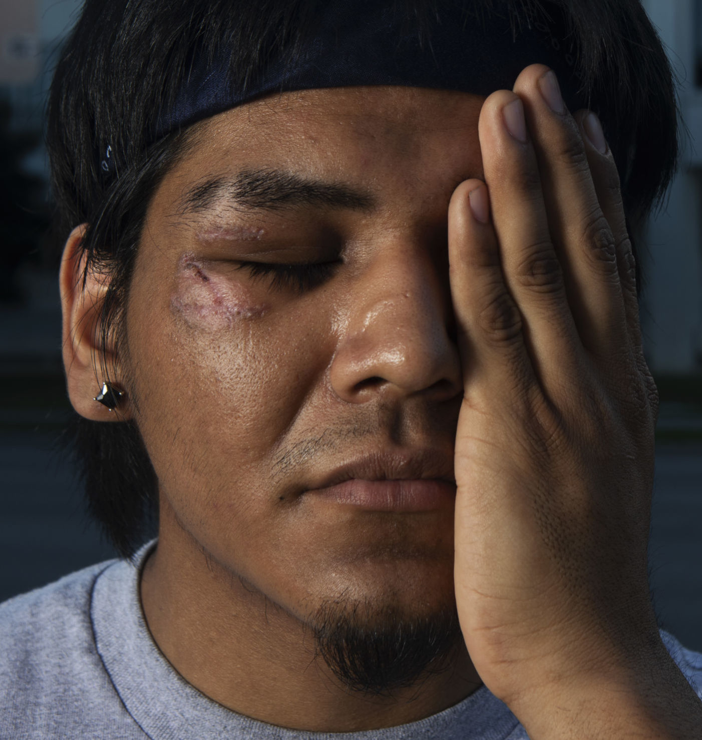 Leo Celis protest injury